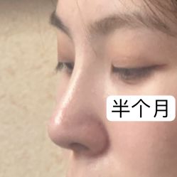 -成都西区医院整形美容