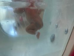 -广州安和泰医学月子会所