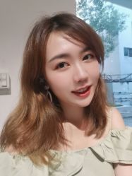 体验后-广州健丽·去眼袋医疗美容机构