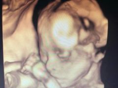 -复旦大学附属上海市第五人民医院·停车场