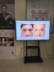 -天津健丽·去眼袋医疗美容机构