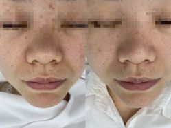 -蕾特恩专业祛痘·皮肤管理