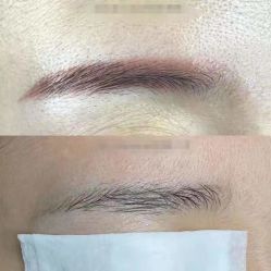 -郡艺医疗美容·微整·眼鼻吸脂