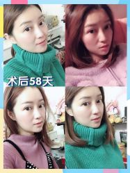 -广东韩妃整形外科医院