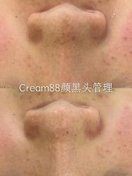 -Cream88颜皮肤管理中心