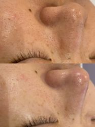 -慈蕊美容养生·专业经络调理