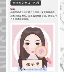 -苗方清颜痘肌研究所