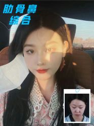 -北京米扬丽格医疗美容·联合丽格鼻整形中心