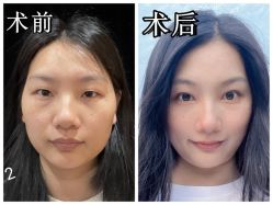 -素美医疗美容·西南眼鼻整形·修复基地