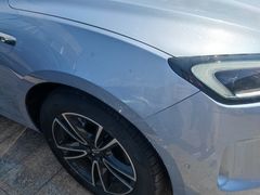 -鲨鱼皮汽车凹陷玻璃修复(静安店)