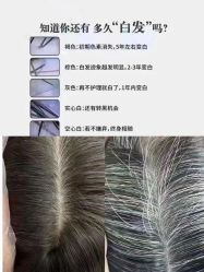 点击看大图 -舒欣头疗·俏丝谧语 白发脱发专业护理