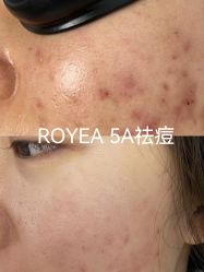 -ROYEA茹彦祛痘·问题肌肤修护中心