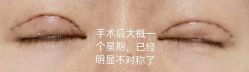 体验后-海峡医疗美容医院