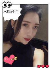 -大麦微针植发全国连锁