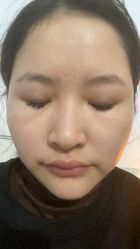 -广州健丽·去眼袋医疗美容机构