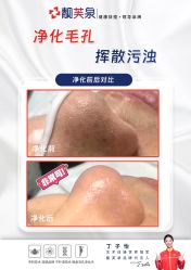 -靓芙泉专研痘痘肌