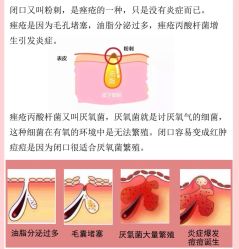 -苗方清颜痘肌研究所