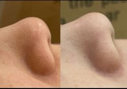 -SKIN79皮肤管理中心