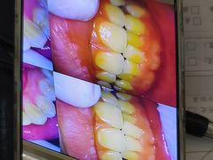 -土豆口腔(凤凰北总店)