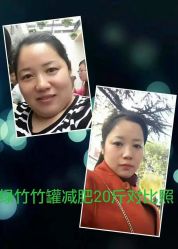 -绿竹·竹罐瘦身养生馆