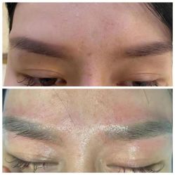 -郡艺医疗美容·微整·眼鼻吸脂