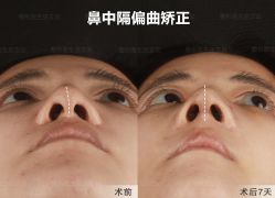 -北京米扬丽格医疗美容·联合丽格鼻整形中心