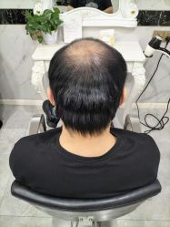 -唐风采假发补发定制