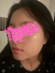 点击看大图 体验前-洁铭新加坡医美