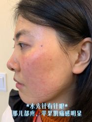 -成都艾特他整形外科医院