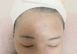 点击看大图 体验后-JUVA郑州欧华医疗美容医院
