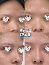 -Yestar重庆艺星医疗美容医院