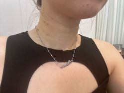 体验后-深圳美莱医疗美容医院