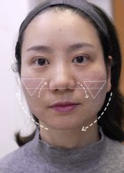 -Yestar重庆艺星医疗美容医院