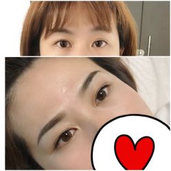 点击看大图 -Doris多里斯半永久纹眉·SMP纹发·发际线