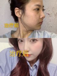-深圳阳光医疗美容医院·旗舰店
