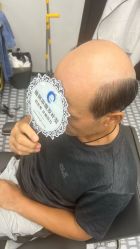 -唐风采假发补发定制