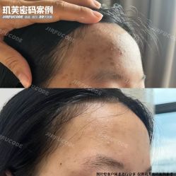 -元熙兰积皮肤管理