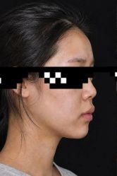 -天津健丽·去眼袋医疗美容机构