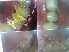 -同步齿科·数字化正畸种植口腔中心(珠海店)