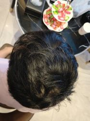 -新生植发·植养护一体