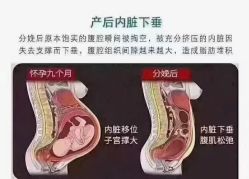 点击看大图 -昕孕瑜伽·孕妇瑜伽·产后修复