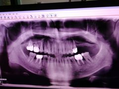 -上海陈守平口腔诊所