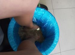 -德哥灰指甲脚气甲沟炎跖疣护理