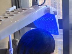 -碧莲盛·不剃发植发