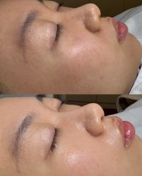 -美愈美肤MEIYU SKIN