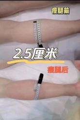 -Lily纤美·科技减脂中心