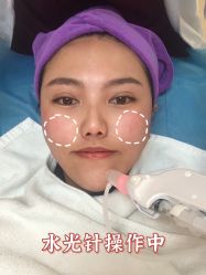 -西安壹加壹医疗美容·西北抗衰旗舰店