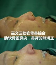 -北京米扬丽格医疗美容·联合丽格鼻整形中心