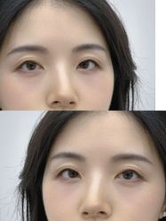 -Doris多里斯半永久纹眉·SMP纹发·发际线