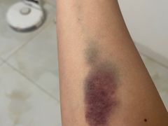 -中国人民解放军总医院